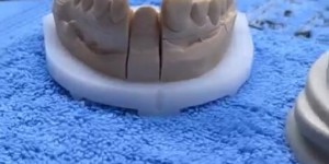 未婚妻出发前磕断牙齿，特拉普千里外为她预约牙医❤️