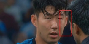 电讯报：孙兴慜手术成功，有望赶上世界杯