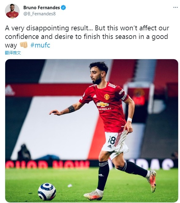 B费：输掉“双红会”令人失望，但这不会影响球队的信心