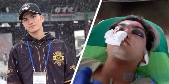 泰国男子在餐厅吃饭时突然被人暴打，疑因长得太帅而导致对方看不顺眼