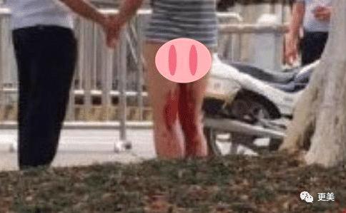 胳膊上长丁丁的男子 比金针菇还惨100倍