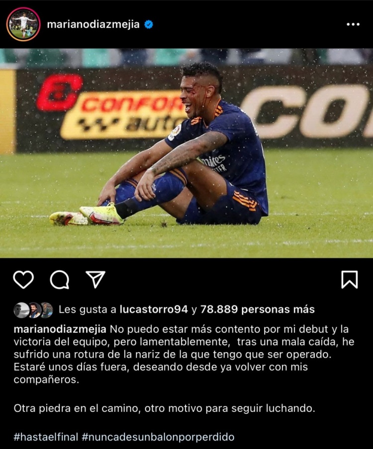 马里亚诺：我的鼻部受伤需要手术，将会缺阵一段时间