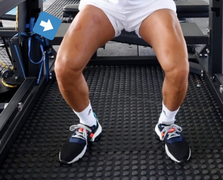 记者:本泽马假期期间每天训练,今天训练前接受了拔罐理疗