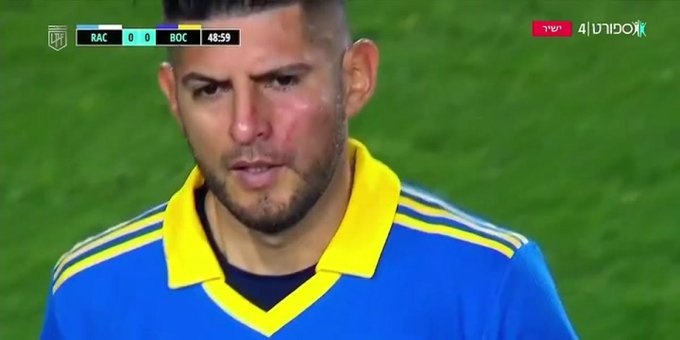 戏剧十足！博卡球员半场休息时打架，对手禁区内手球VAR未判点